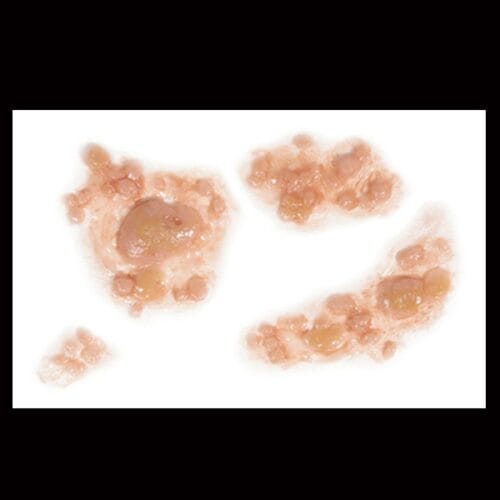 Outbreak - FX Makeup