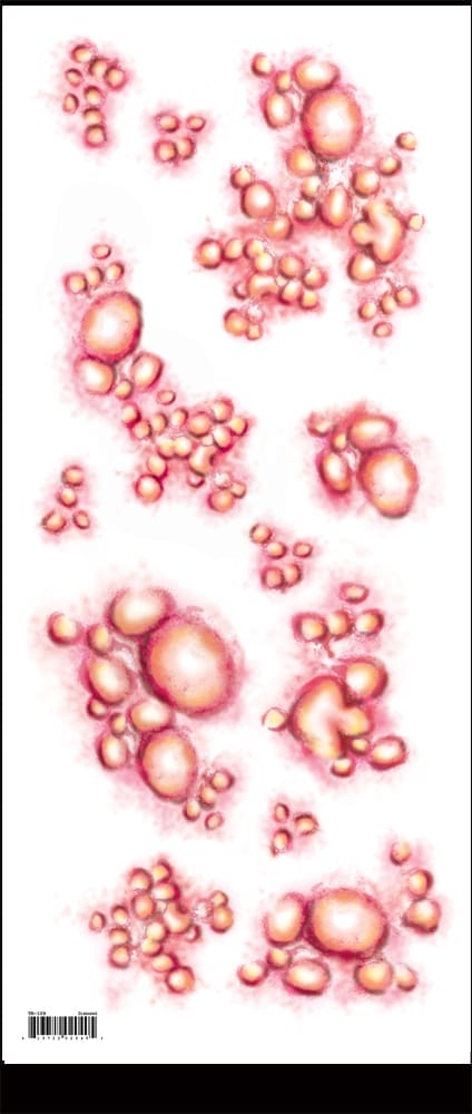 Diseased - Temporary Tattoo