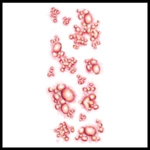 Diseased - Temporary Tattoo