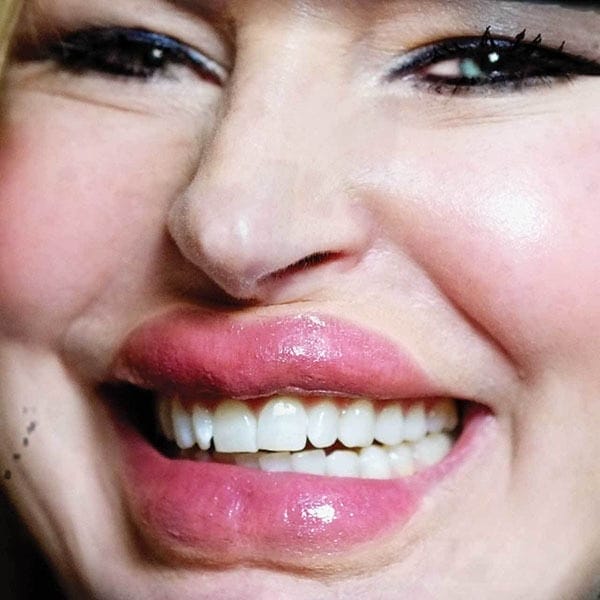 Lip/Tuck DFXTransfers