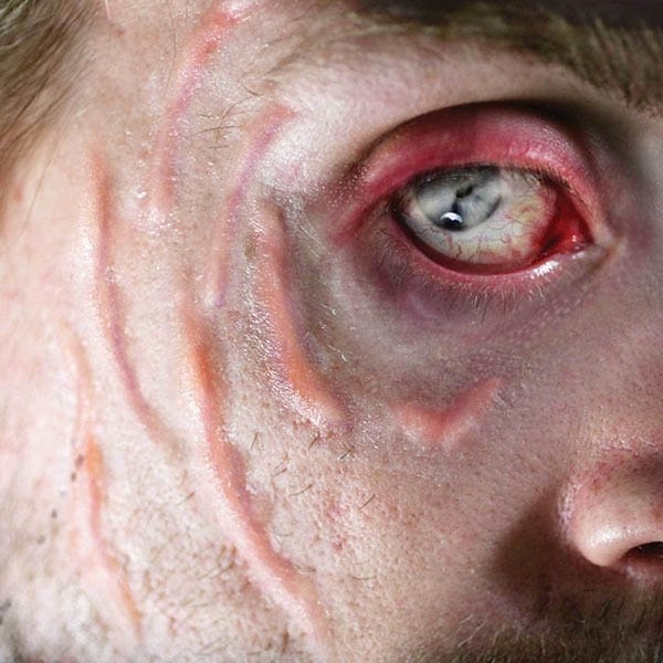 Scarred FX Transfers