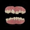 Zombie TeethFX